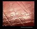 colonies of pneumococci, cololony morphology of S.pneumoniae